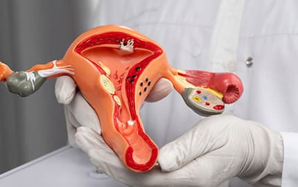 Gynecology Diagram