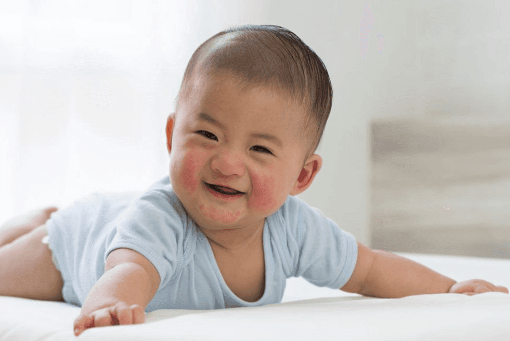 Viral Rash Allergies and Fever Rash in Pediatrics: Symptoms, Causes, and Treatment Guide